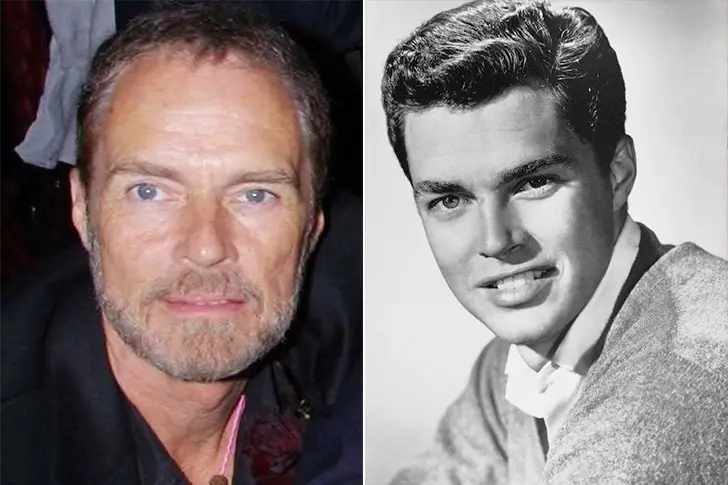 Richard Beymer – 80
