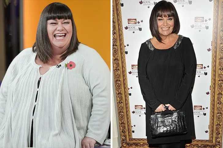Dawn French – 98lbs – Long Walks & Healthier Diet