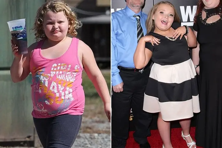 Alana “Honey Boo Boo” Thompson – Avoid Greasy food and Adopt Healthy Lifestyle