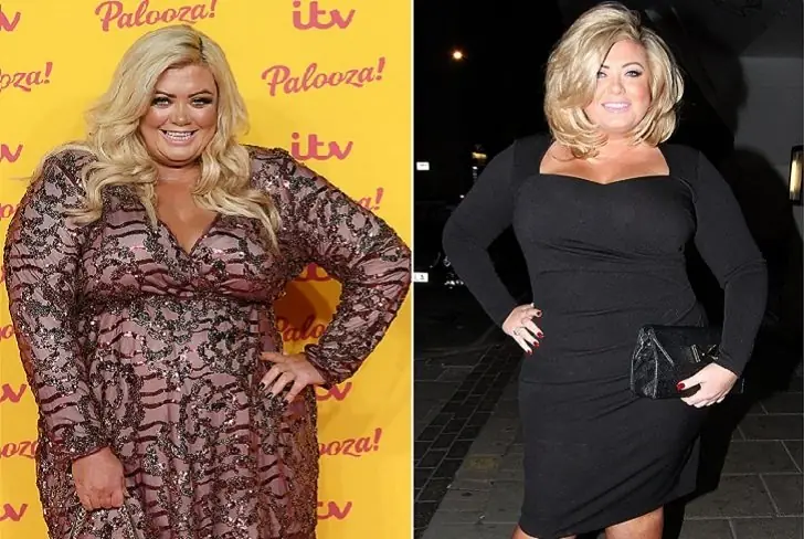 Gemma Collins – 40 lbs – Strict Diet