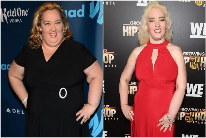 Mama June – 100lbs – Gastric Sleeve Surgery and Skin Removal Surgery
